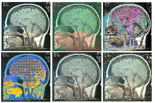 Brain Scans
